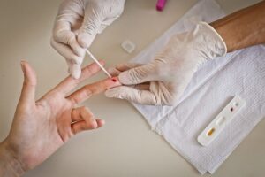 Com testagem e tratamento imediato, DF reduz número de mortes por HIV